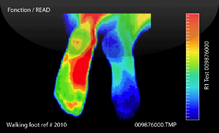 Thermographe du pied après une séance de marche Thermographe du pied après une séance de marche
